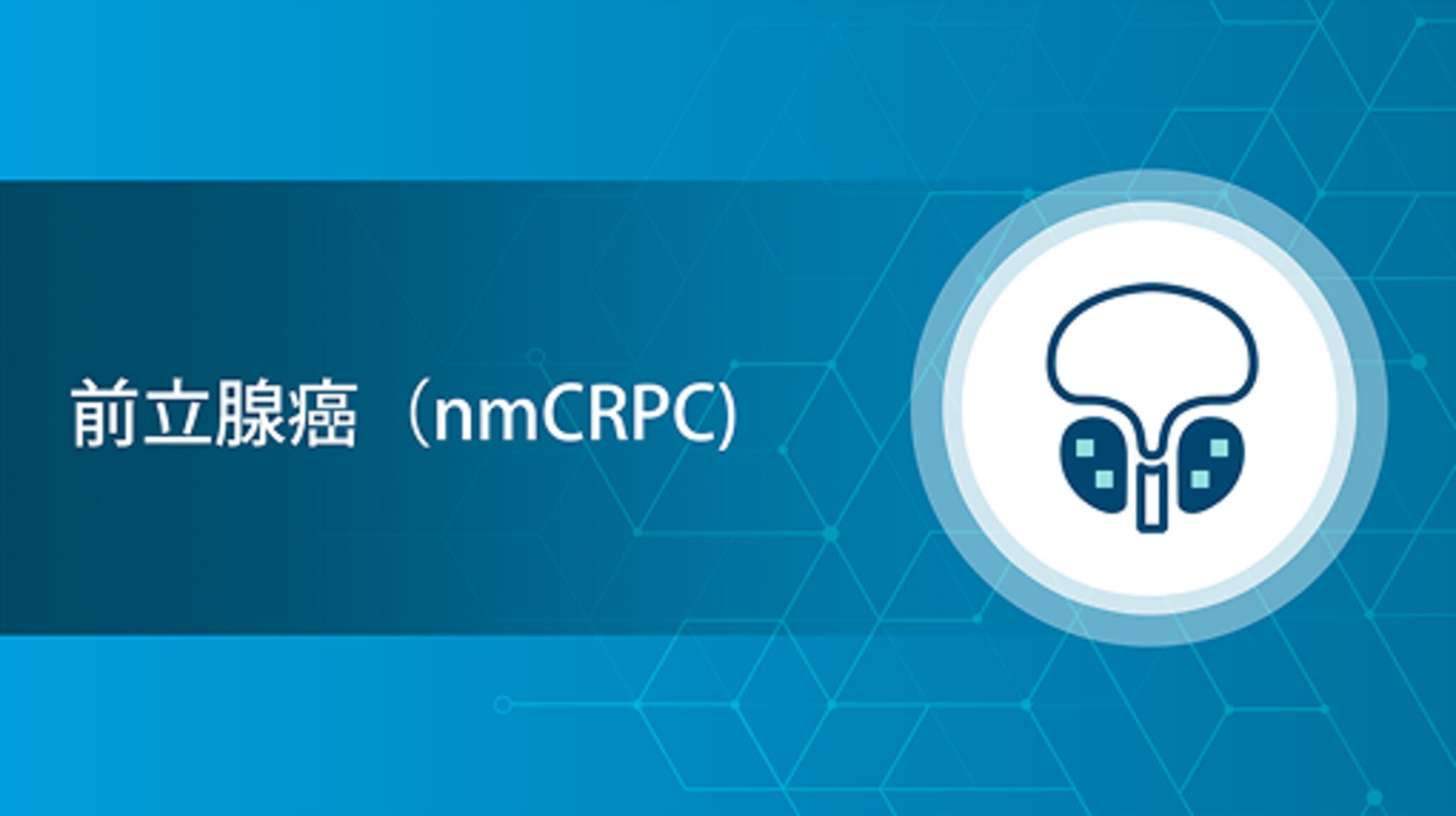 前立腺癌（nmCRPC）