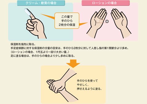 手足症候群の予防方法