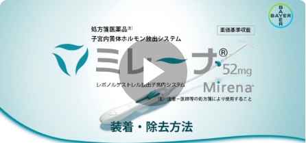 ミレーナ52mgの装着・除去方法動画