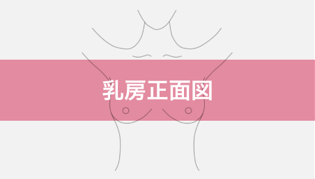 乳房正面図