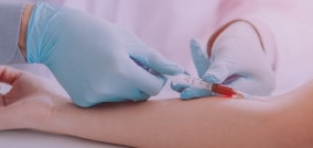 Xarelto Tube